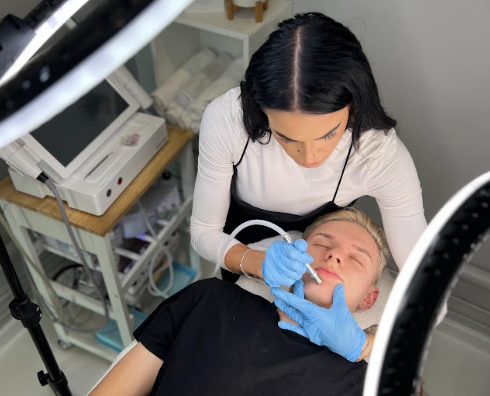 Microdermabrasion